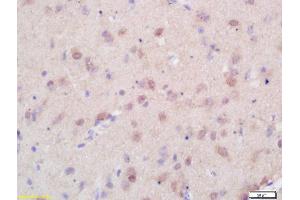 Formalin-fixed and paraffin embedded rat brain labeled with Rabbit Anti Menin/Men1 Polyclonal Antibody, Unconjugated (ABIN676343) at 1:200 followed by conjugation to the secondary antibody and DAB staining (Menin anticorps  (AA 501-615))