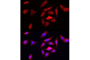 Immunofluorescence analysis of U2OS cells using ODC1 Rabbit pAb (ABIN3015743, ABIN3015744, ABIN3015745 and ABIN6219097) at dilution of 1:50 (40x lens). (ODC1 anticorps  (AA 1-280))
