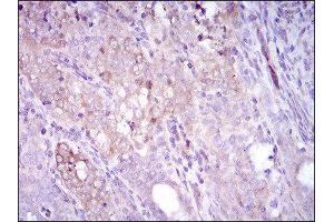 Immunohistochemistry (IHC) image for anti-Sequestosome 1 (SQSTM1) (AA 232-356) antibody (ABIN1846090) (SQSTM1 anticorps  (AA 232-356))