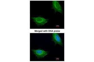 ICC/IF Image Immunofluorescence analysis of paraformaldehyde-fixed HeLa, using ADCK1, antibody at 1:200 dilution.
