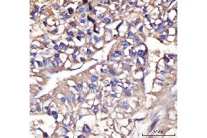 IHC analysis of IFIT5 using anti-IFIT5 antibody (ABIN7600752). (IFIT5 anticorps  (AA 23-439))