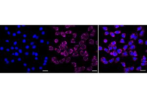 Immunocytochemical staining of C2C12 cells with IDH2 antibody (ABIN7799134), 1:1,000).