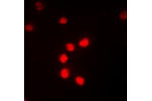 Immunofluorescent analysis of NF-kappaB p65 (pT435) staining in K562 cells. (NF-kB p65 anticorps  (C-Term, pSer435))