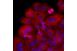 Immunofluorescence (IF) image for anti-Tubulin, beta 2B (TUBB2B) antibody (ABIN567629) (TUBB2B anticorps)