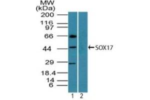 Image no. 1 for anti-SRY (Sex Determining Region Y)-Box 17 (SOX17) (AA 120-170) antibody (ABIN960351) (SOX17 anticorps  (AA 120-170))
