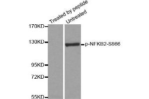 Western Blotting (WB) image for anti-Nuclear Factor of kappa Light Polypeptide Gene Enhancer in B-Cells 2 (NFKB2) (pSer866) antibody (ABIN1870473) (NFKB2 anticorps  (pSer866))