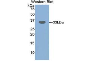 Western blot analysis of the recombinant protein. (TGFBR3 anticorps  (AA 210-465))