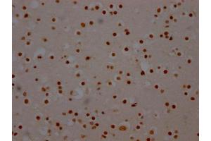 IHC image of ABIN7127805 diluted at 1:100 and staining in paraffin-embedded human brain tissue performed on a Leica BondTM system. (Recombinant SF3B1 anticorps)