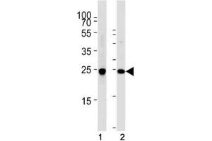 Western blot analysis of lysate from (1) SH-SY5Y cell line and (2) mouse brain tissue using PGP 9.