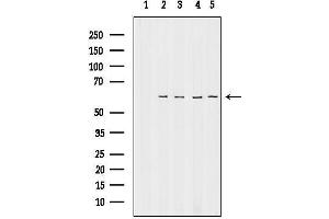 Western blot analysis of lysates from various samples, using TIG Antibody.
