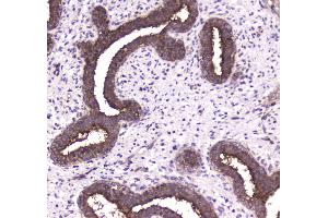 IHC analysis of 14-3-3 zeta/delta using anti-14-3-3 zeta/delta antibody . (14-3-3 zeta anticorps)