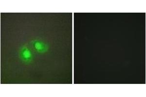 Immunofluorescence analysis of A549 cells, using TOP2A Antibody.