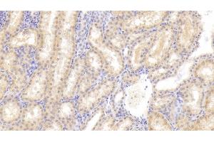 Detection of FIGN in Human Kidney Tissue using Polyclonal Antibody to Fidgetin (FIGN) (Fidgetin anticorps  (AA 1-308))