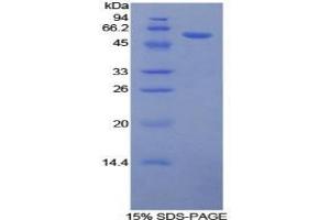 SDS-PAGE of Protein Standard from the Kit (Highly purified E. (Glucocorticoid Receptor Kit ELISA)