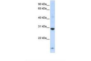 Image no. 1 for anti-Zinc Finger Protein 138 (ZNF138) (AA 177-226) antibody (ABIN6738382) (ZNF138 anticorps  (AA 177-226))