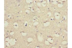 Immunohistochemistry of paraffin-embedded human brain tissue using ABIN7158053 at dilution of 1:100 (LINGO1 anticorps  (AA 42-240))
