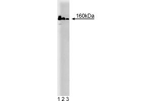 Western Blotting (WB) image for anti-MutS Homolog 6 (E. Coli) (MSH6) (AA 225-333) antibody (ABIN968248) (MSH6 anticorps  (AA 225-333))