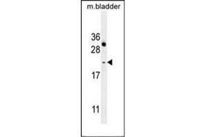 Western blot analysis of NAT14 Antibody (N-term) in mouse bladder tissue lysates (35ug/lane). (NAT14 anticorps  (N-Term))