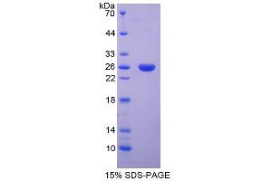 SDS-PAGE analysis of Rat SPB Protein. (SFTPB Protéine)