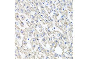 Immunohistochemistry of paraffin-embedded human liver injury using OTC antibody. (OTC anticorps)
