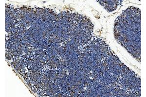 IHC analysis of BUB1 using anti-BUB1 antibody (ABIN7600942). (BUB1 anticorps  (AA 26-1085))