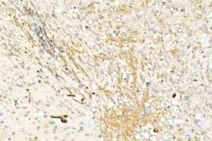 Immunohistochemistry analysis of paraffin-embedded mouse brain using,DMPK (ABIN7073790) at dilution of 1: 2000