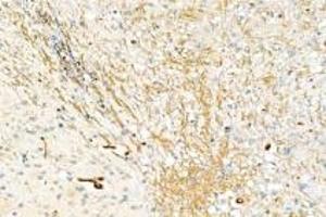 Immunohistochemistry analysis of paraffin-embedded mouse brain using,DMPK (ABIN7073790) at dilution of 1: 2000 (DMPK anticorps)