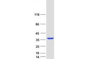 Validation with Western Blot