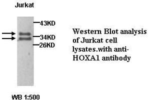 Image no. 1 for anti-Homeobox A1 (HOXA1) antibody (ABIN1577055) (HOXA1 anticorps)
