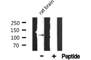 Western blot analysis of extracts from rat brain, using Collagen VI α2 antibody. (COL6A2 anticorps  (Internal Region))