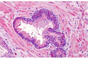 Human Prostate: Formalin-Fixed, Paraffin-Embedded (FFPE)
