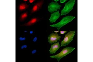 ABIN6265446 and ABIN6278639 staining  cells by IF/ICC. (TAL1 anticorps  (C-Term))