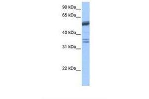 Image no. 1 for anti-Coilin (COIL) (AA 460-509) antibody (ABIN6738870) (Coilin anticorps  (AA 460-509))