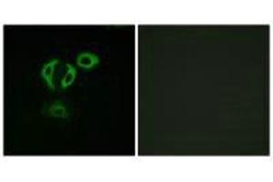 Immunofluorescence analysis of A549cells, using TACC3 antibody.