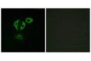 Immunofluorescence analysis of A549cells, using TACC3 antibody. (TACC3 anticorps  (C-Term))