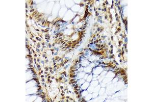 Immunohistochemistry of paraffin-embedded human colon using COPS3 Rabbit mAb (ABIN7266498) at dilution of 1:100 (40x lens). (COPS3 anticorps)