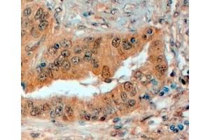 ABIN334487 (4µg/ml) staining of paraffin embedded Human Prostate. (SEMA3E anticorps  (Internal Region))