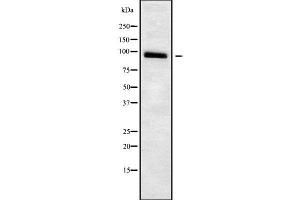 Western blot analysis of ADAM23 using Jurkat whole cell lysates (Adam23 anticorps  (C-Term))