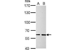 WB Image SOCS5 antibody detects SOCS5 protein by Western blot analysis.