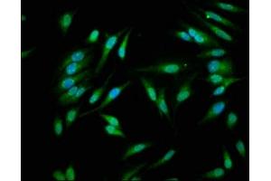 Immunofluorescence staining of Hela cells with ABIN7146926 at 1:266, counter-stained with DAPI. (Caspase 1 anticorps  (AA 120-269))