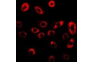Immunofluorescent analysis of GILZ staining in U2OS cells.