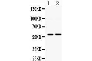 Observed bind size: 60KD (DGAT1 anticorps  (Middle Region))