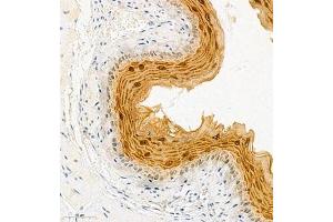 Immunohistochemistry of paraffin embedded mouse esophagus using SPRR3 (ABIN7075637) at dilution of 1:2000 (300x lens) (SPRR3 anticorps)