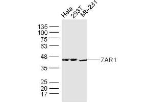 Human Hela, 293T, and Mb-231 cells probed with ZAR1 Polyclonal Antibody, unconjugated  at 1:300 overnight at 4°C followed by a conjugated secondary antibody at 1:10000 for 90 minutes at 37°C. (Zygote Arrest 1 anticorps  (AA 351-424))