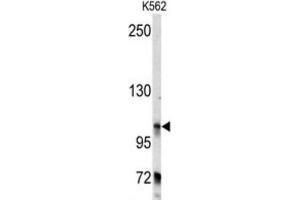 Western Blotting (WB) image for anti-Bicaudal D Homolog 2 (BICD2) antibody (ABIN3003477) (BICD2 anticorps)