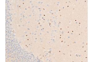 ABIN6267224 at 1/100 staining mouse brain tissue sections by IHC-P. (CHEK1 anticorps  (pSer317))