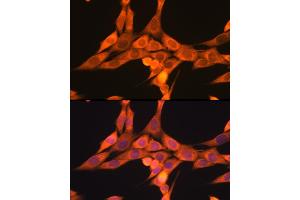 Immunofluorescence analysis of NIH/3T3 cells using DRP1 Rabbit pAb (ABIN3023669, ABIN3023670, ABIN3023671, ABIN1679564 and ABIN6219696) at dilution of 1:100 (40x lens).