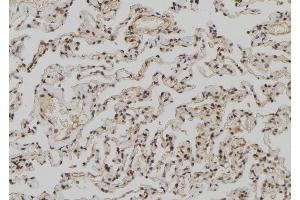 ABIN6273027 at 1/100 staining Human lung tissue by IHC-P. (ZCCHC11 anticorps  (Internal Region))