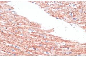Immunohistochemistry of paraffin-embedded Mouse heart using FZD4 Polyclonal Antibody at dilution of 1:100 (40x lens). (FZD4 anticorps)