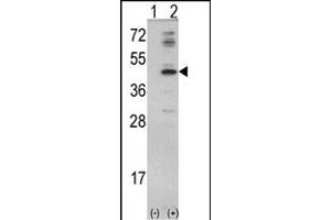 Western blot analysis of MVD (arrow) using rabbit polyclonal MVD Antibody (N-term) (ABIN390673 and ABIN2840969). (MVD anticorps  (N-Term))